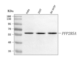 Anti-PPP2R5A Antibody