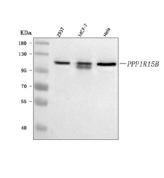 Anti-PPP1R15B Antibody