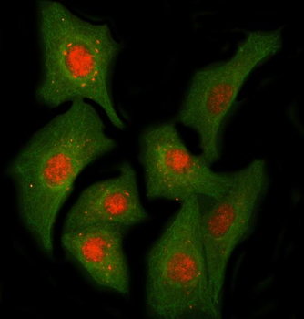 Anti-PPIL2 Antibody