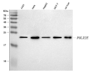 Anti-RPB5/POLR2E Antibody