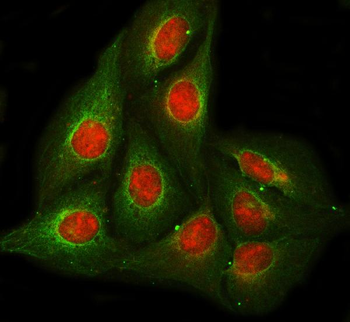 Anti-RPB5/POLR2E Antibody