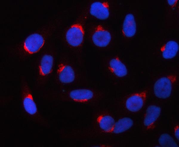 Anti-PRRC1 Antibody