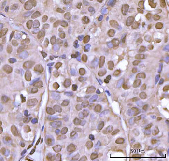 Anti-NEIL3 Antibody