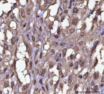 Anti-NEIL3 Antibody