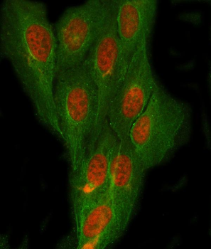 Anti-NDRG4 Antibody