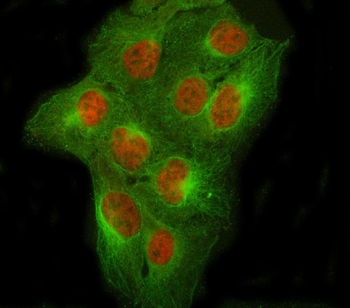Anti-NCOR2 Antibody