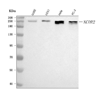 Anti-NCOR2 Antibody