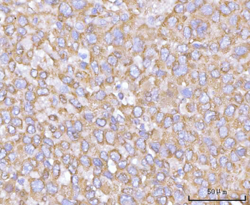 Anti-NANP Antibody
