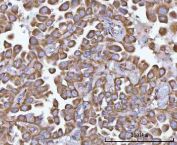 Anti-NANP Antibody