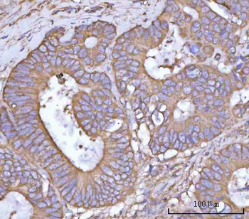 Anti-NANP Antibody
