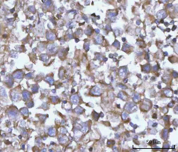 Anti-NANP Antibody