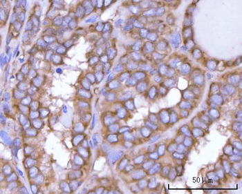 Anti-NANP Antibody