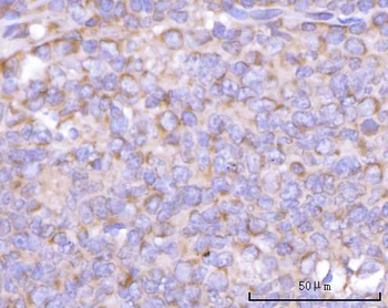 Anti-NANP Antibody