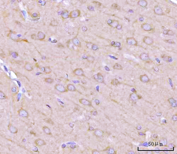 Anti-NANP Antibody