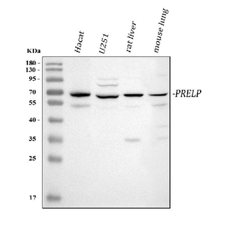 Anti-PRELP Antibody