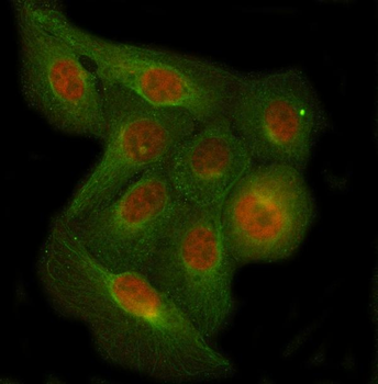 Anti-C7orf47/PPP1R35 Antibody