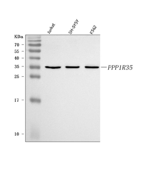 Anti-C7orf47/PPP1R35 Antibody