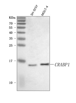 Anti-CRABP1 Antibody