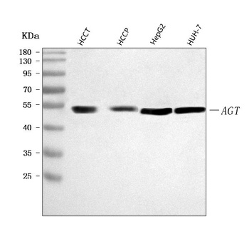 Anti-Angiotensinogen/AGT Antibody
