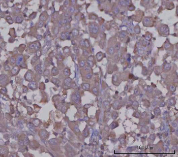 Anti-Angiotensinogen/AGT Antibody