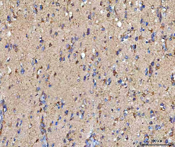 Anti-MOSPD2 Antibody