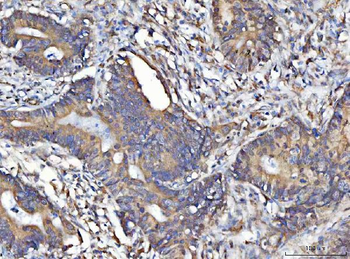 Anti-MOSPD2 Antibody