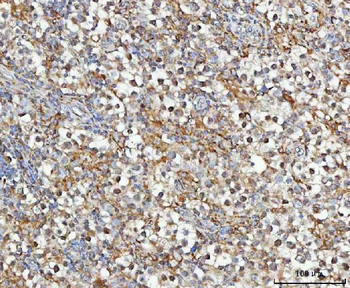 Anti-MOSPD2 Antibody
