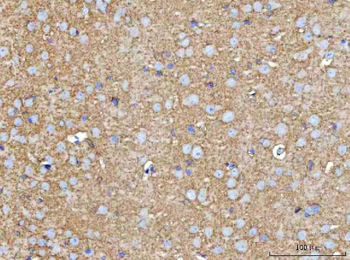 Anti-MOSPD2 Antibody