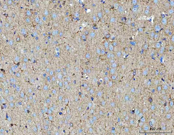 Anti-MOSPD2 Antibody
