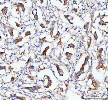 Anti-MOGAT2 Antibody