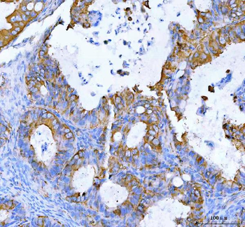 Anti-MOGAT2 Antibody