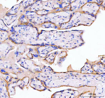 Anti-MOGAT2 Antibody