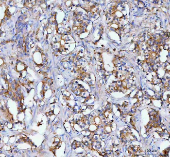 Anti-MOGAT2 Antibody