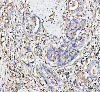 Anti-MOGAT2 Antibody
