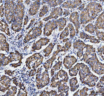 Anti-DAPK1 Antibody