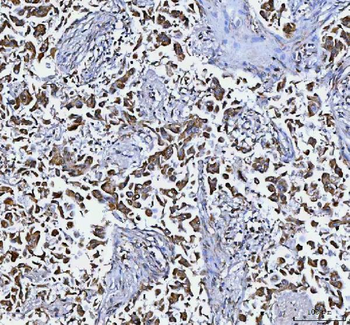 Anti-DAPK1 Antibody