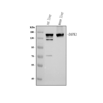 Anti-DAPK1 Antibody