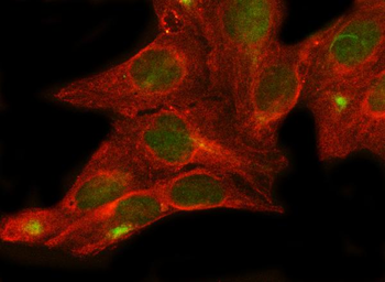 Anti-MLST8 Antibody