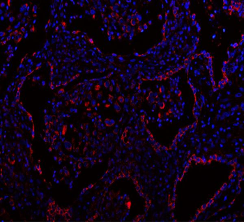 Anti-MLST8 Antibody