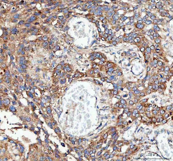 Anti-MLST8 Antibody