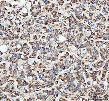Anti-MLST8 Antibody