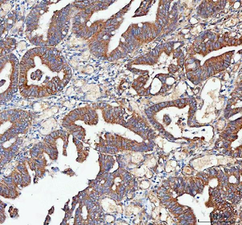 Anti-MLST8 Antibody