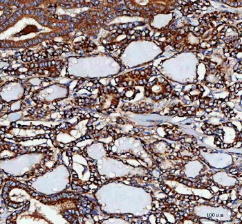 Anti-MLST8 Antibody