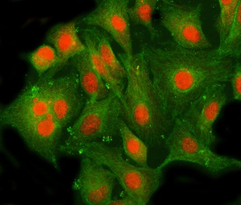 Anti-MLLT10 Antibody