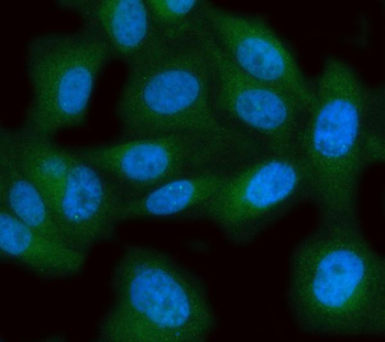Anti-MPST Antibody