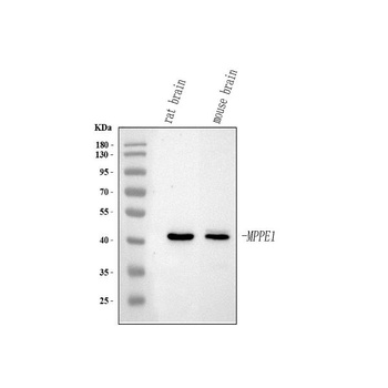 Anti-MPPE1 Antibody