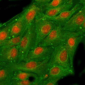 Anti-NSFL1C Antibody
