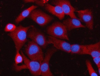 Anti-MELK Antibody