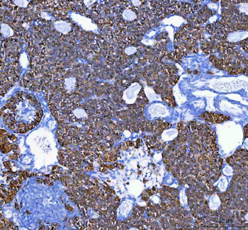 Anti-MELK Antibody