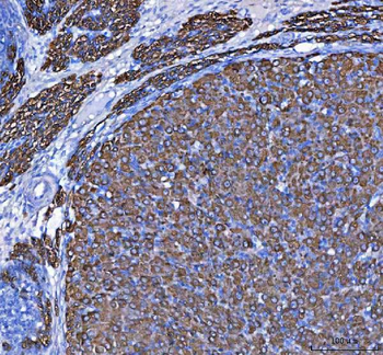 Anti-MELK Antibody